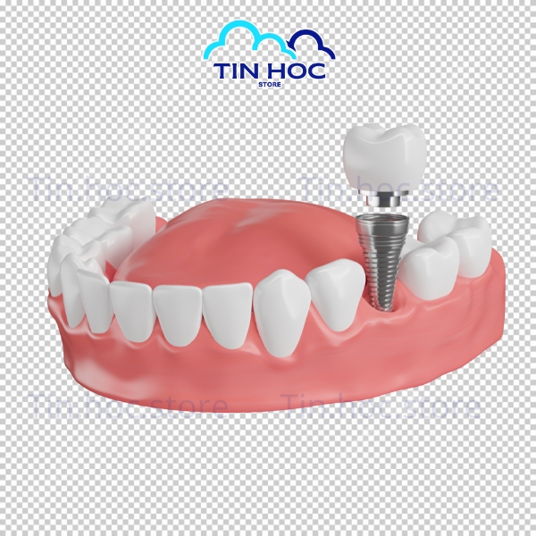 Mẫu răng vector PNG dùng ngay